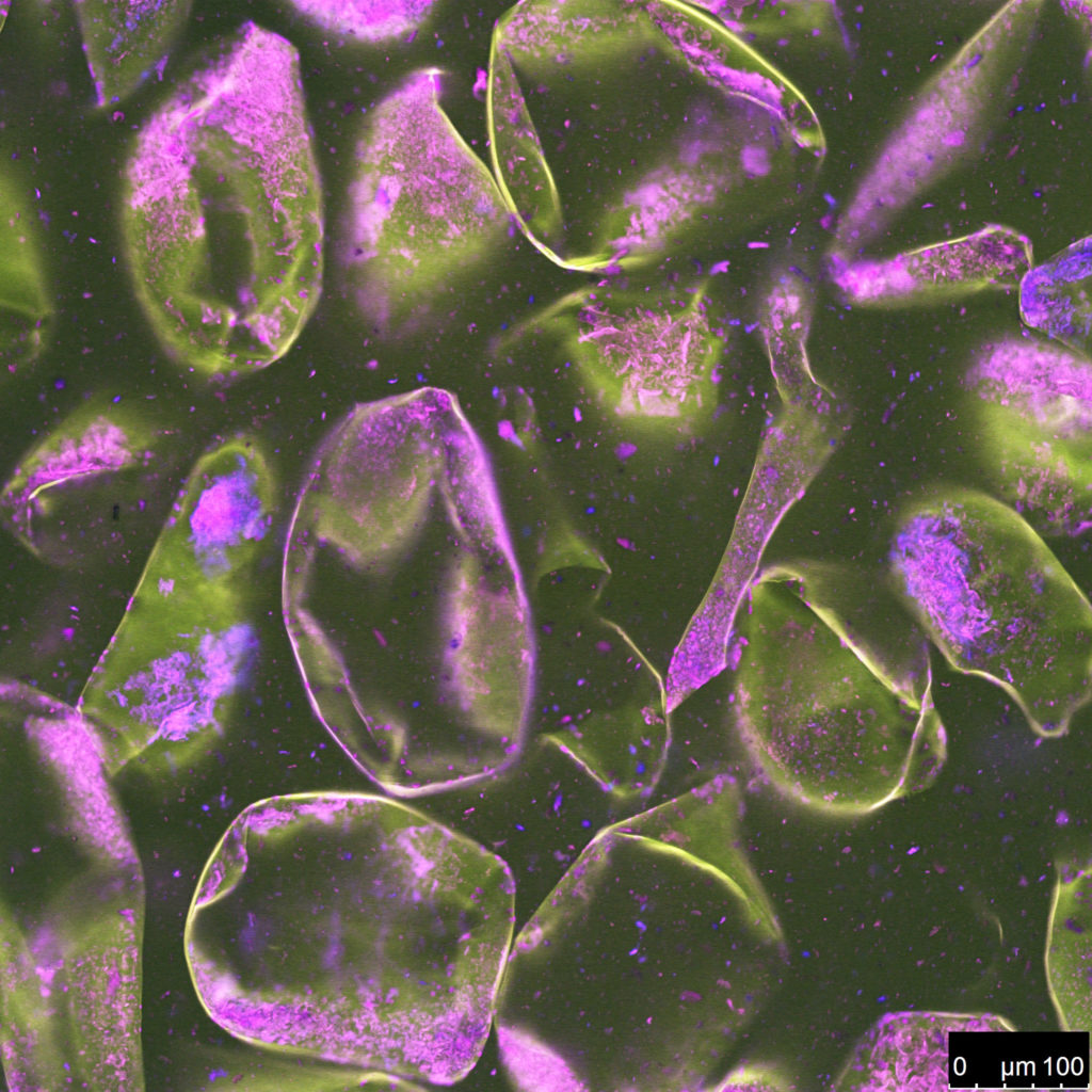 Consistence apple sauce (appelmoes) confocal image, acridine orange. by Paul Nijsse.