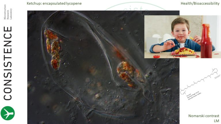 Differential Interference Contrast image of tomato cell in ketchup, with encapsulated lycopene crystals. By Jaap Nijsse, Consistence Microstructure Research Laboratory