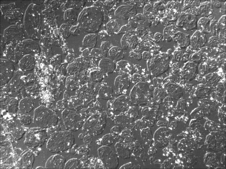 Differential Interference Contrast Light Microscopy image of a commercial tomato ketchup. Here this method highlights cell walls and swollen starch grains. The same area has been imaged with LM-BF and LM-CPOL as well. Photo by Jaap Nijsse, Consistence Microstructure Research Laboratory.