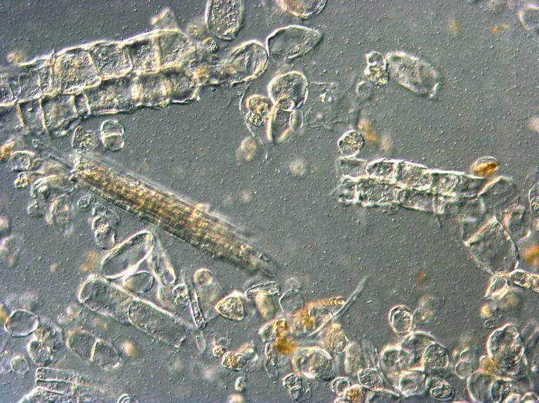 Differential Interference Contrast Microscopy (LM-DIC or Nomarski) image of Cabbage hotbreak puree.Photo by Jaap Nijsse, Consistence Microstructure Research Laboratory.