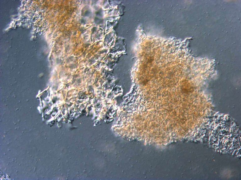 Differential Interference Contrast Microscopy (LM-DIC or Nomarski) image of Cabbage coldbreak puree. Photo by Jaap Nijsse, Consistence Microstructure Research Laboratory.