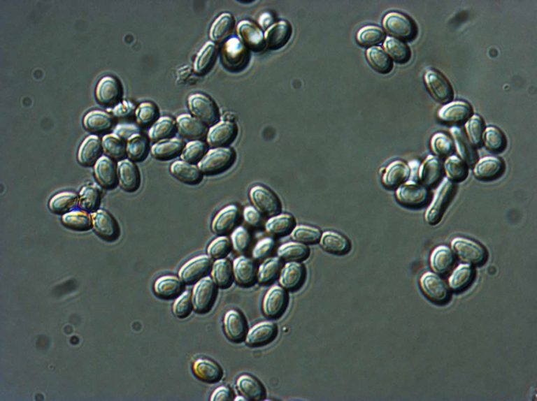 Differential Interference Contrast Microscopy (LM-DIC or Nomarski) image of fungal spores in citrus fruit. Image Width is 84µm. Photo by Jaap Nijsse, Consistence Microstructure Research Laboratory.