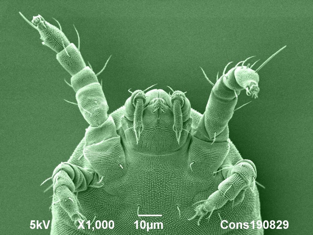 cryo-SEM image of a mite found on a hydrangea leaf. Image width 130µm. Jaap Nijsse, www.consistence.nl