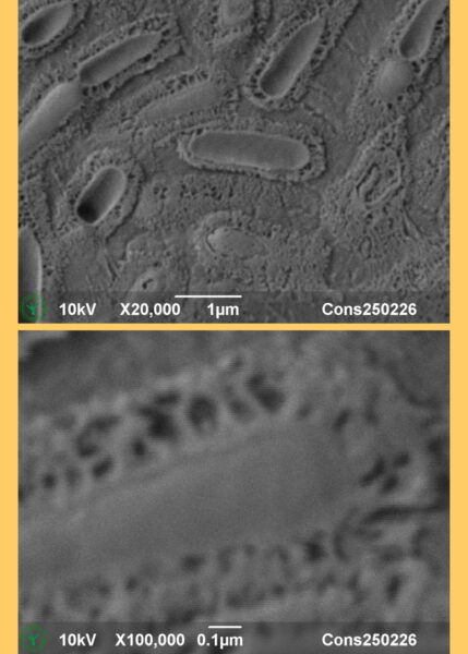 Read more about the article Bacterial capsules