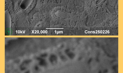 250501LinkedInBacteriac