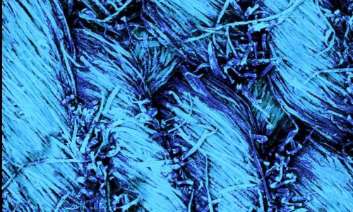 Confocal Microscopy image of worn jeans textile. Denim. Autofluorescence signal, 3D projection. Photo by Paul Nijsse, www.Consistence.nl